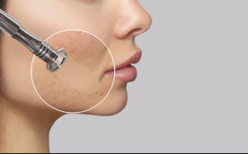 Introductie-aanbieding 2: